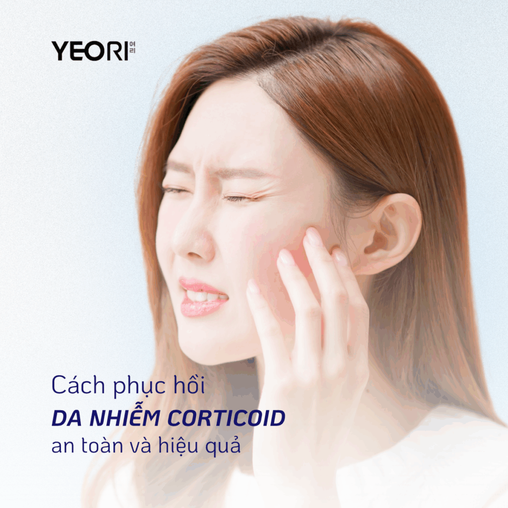 CÁCH PHỤC HỒI LÀN DA NHIỄM CORTICOID AN TOÀN VÀ HIỆU QUẢ